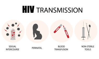 HIV enfeksiyonu bulaşma yöntemleri. Posterde HIV bulaşmış. Anneden çocuğa, korunmasız seksle, steril olmayan tıbbi aletlerle, kan nakliyle. Vektör