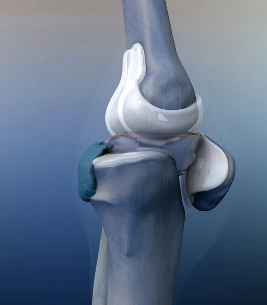 Ból ilustracja stawu kolanowego po stronie — Zdjęcie stockowe