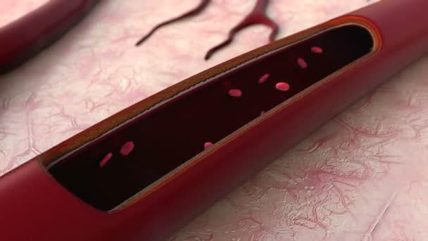 Arterie mit ausgeschnittenem Schnitt — Stockvideo