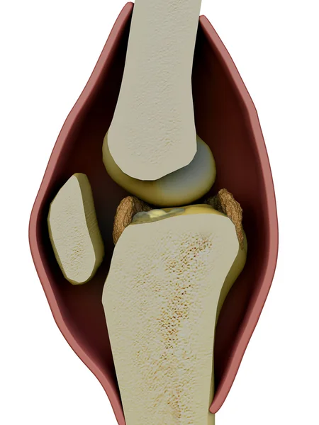 Rodilla, hueso — Foto de Stock