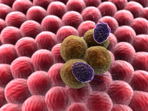 Раковые клетки атакованы лимфоцитами — стоковое фото