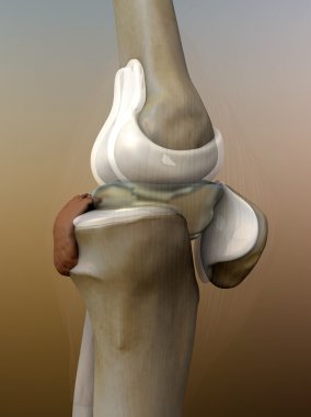 insan diz, artrit