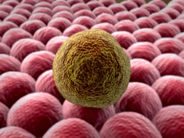 Células cancerígenas ao microscópio Imagem De Stock