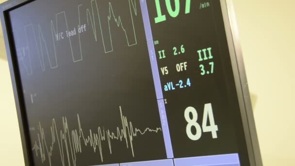 Компіляція декількох відео моніторів серцевого ритму в хірургічній та екстреній кімнаті, що показують серцебиття з різних позицій та декількох ліжок пацієнтів — стокове відео