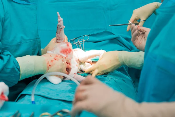 Echte operatie voor cesarean afdeling — Stockfoto