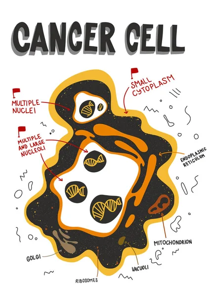 Раковые Клетки Структуры Анатомия Раковых Клеток Характеристика Рака Doodle Плоская — стоковый вектор