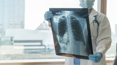 Doktor, astım, akciğer hastalığı, COVID-19 veya radyolojik göğüs röntgeni ile kemik kanseri hastalığı teşhisi koydu.