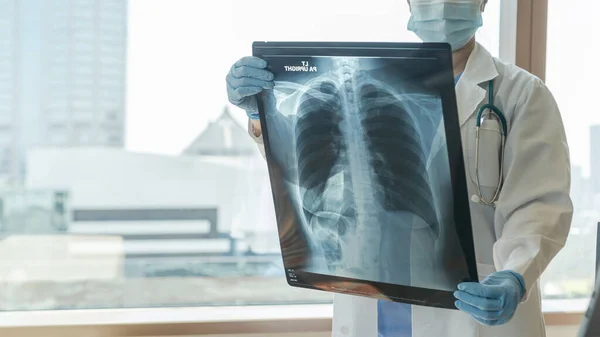Doktor, astım, akciğer hastalığı, COVID-19 veya radyolojik göğüs röntgeni ile kemik kanseri hastalığı teşhisi koydu.
