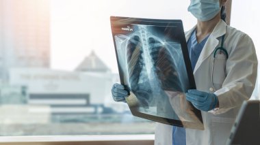 Akciğer hastalığı, covid-19, astım ya da kemik kanseri hastalığı. Doktor, hastanın sağlığına radyolojik göğüs röntgeni teşhisi koydu.