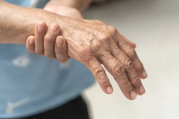 Guillain Barre Syndrome Gbs Peripheral Neuropathy Pain Elderly Patient Hand — Stock Photo, Image