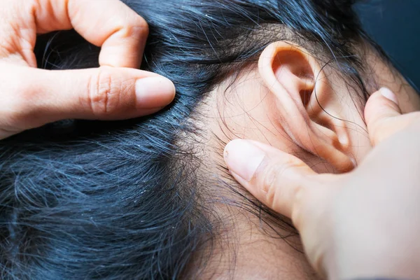 Piojo en el cabello humano — Foto de Stock