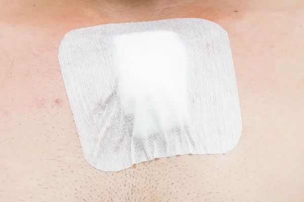 Göğüs cerrahi yara