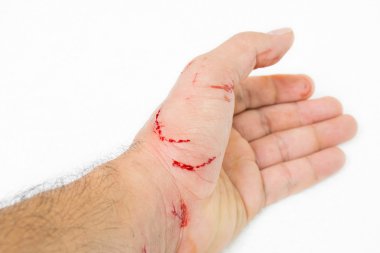 Fresh wound and blood from a bite cat clipart