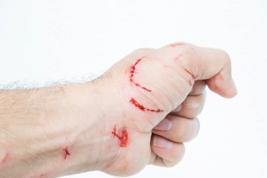 Fresh wound and blood from a bite cat clipart