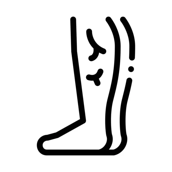 Нога з варикозним розширенням вен чорна ікона Векторні ілюстрації — стоковий вектор