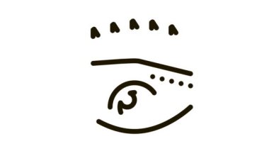 Kaş ameliyatı Simge Canlandırması