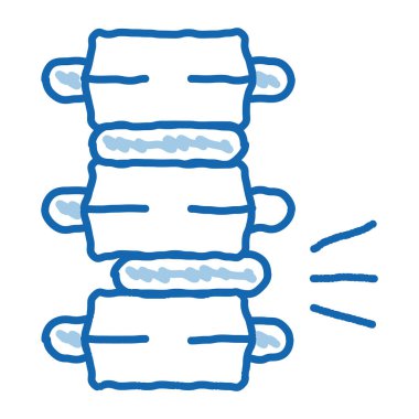 Problem Ağrı Spinal Sütun Dairesel Disk taslak ikon vektörü. El çizimi mavi çizgili sanat izole edilmiş sembol çizimi