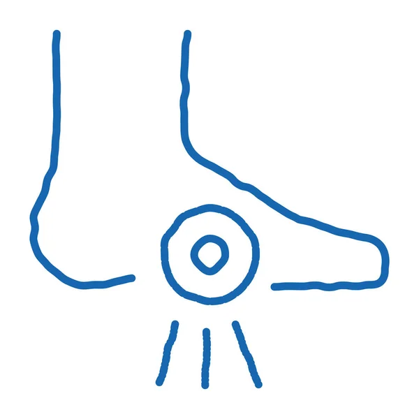 Calcanhar Dor Ortopédica Elemento Esboço Ícone Vetor Mão Desenhado Azul — Vetor de Stock