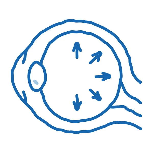 Eyeball Disorder Skizziert Symbolvektor Handgezeichnete Blaue Doodle Line Art Eyeball — Stockvektor