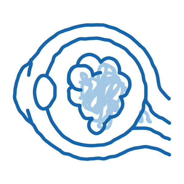 Katarakt Augen Skizzieren Symbolvektor Handgezeichnete Blaue Doodle Line Art Cataract — Stockvektor