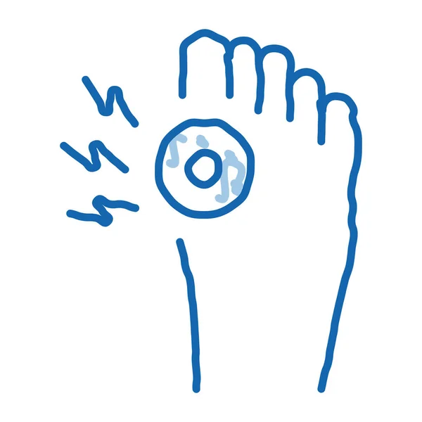 Artrite de osso no pé doodle ícone mão desenhada ilustração — Vetor de Stock