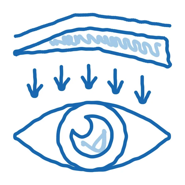 Sobrancelha para baixo cirurgia doodle ícone mão desenhada ilustração — Vetor de Stock