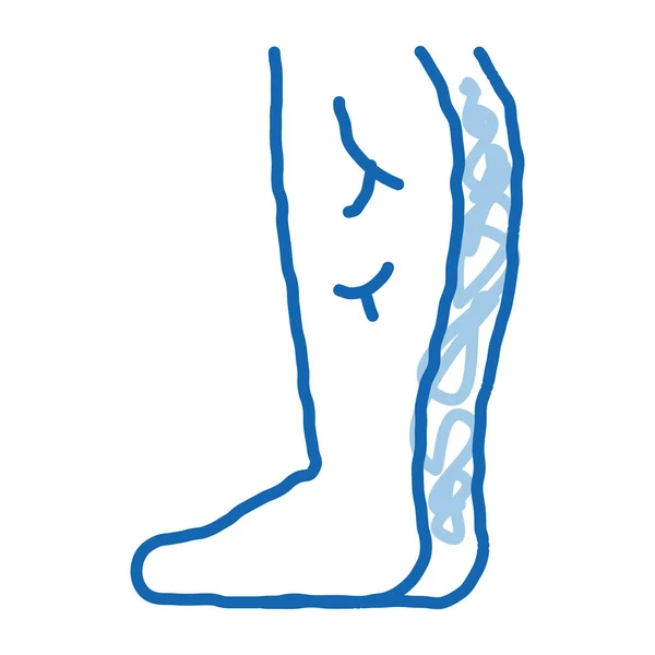 静脈瘤の脚ドアアイコン手描きイラスト — ストックベクタ