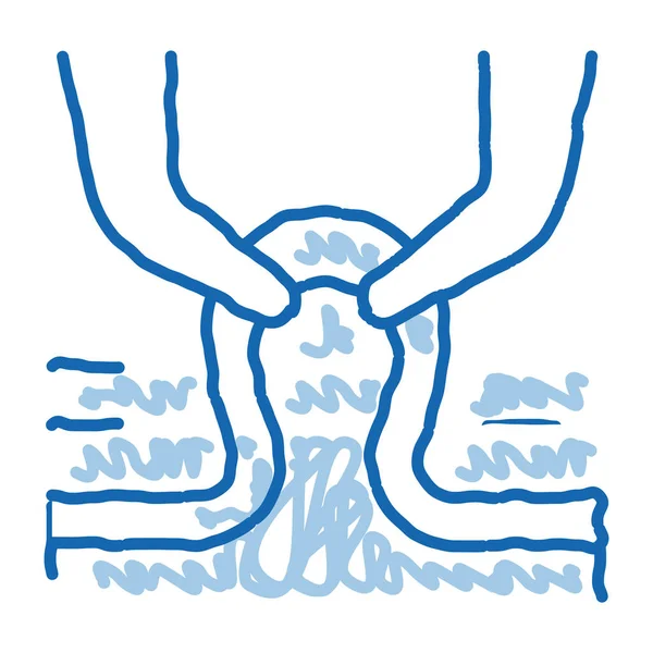 Φλεβίτιδα ιατρική θεραπεία doodle εικονίδιο χέρι ζωγραφισμένα εικόνα — Διανυσματικό Αρχείο