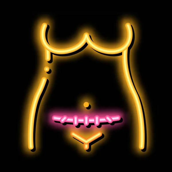 Kaiserschnitt Neonlicht Signalvektor Leuchtend Helles Symbol Kaiserschnitt Zeichen Transparente Symboldarstellung — Stockvektor