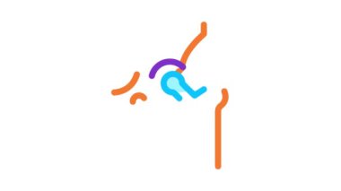 Kalça İmplantı Değiştirme Biyomateryal Simgesi Canlandırması