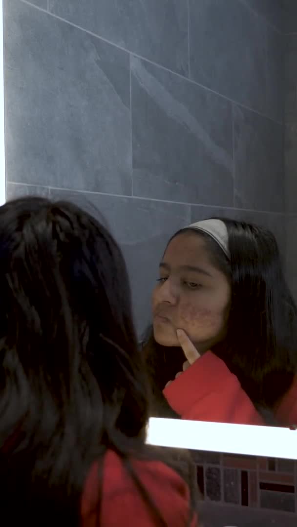 Молодая Женщина Подросток Проверяет Прыщи Зеркале Ванной Вертикальное Видео Утерянное — стоковое видео