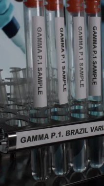 Gamma P.1 Brazil Variant Test Tube Sample Vials Taken Off From Rack. Vertical Video, Locked Off
