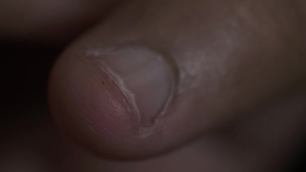 Close Fingernail Ethnic Minority Adult Male Dalam Bahasa Inggris Terkunci — Stok Video