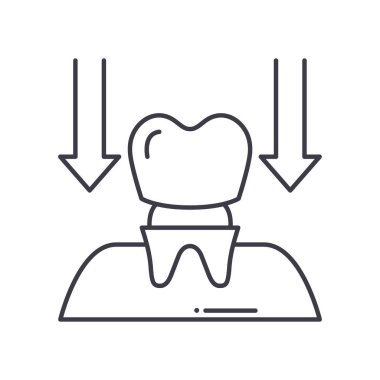 Diş kaplaması simgesi, doğrusal izole edilmiş illüstrasyon, ince çizgi vektörü, web tasarım işareti, düzenlenebilir beyaz arkaplan üzerinde çizgi konsept sembolü.