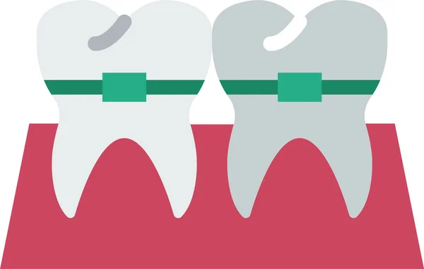 Dentatura Bretelle Impianto Vettoriale Illustrazione — Vettoriale Stock