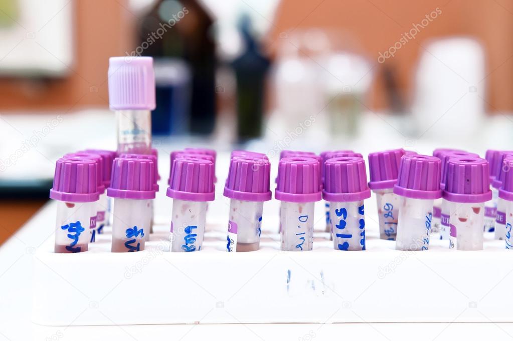blood testing in laboratory