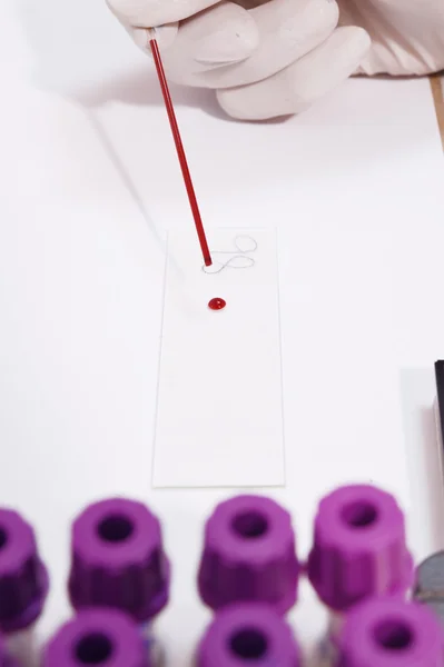 Análises ao sangue em laboratório — Fotografia de Stock