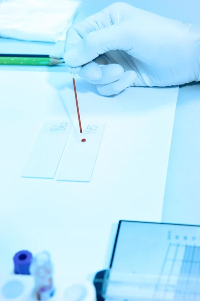 Blood testing in laboratory — Stock Photo, Image