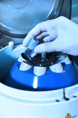 kan laboratuarda test 