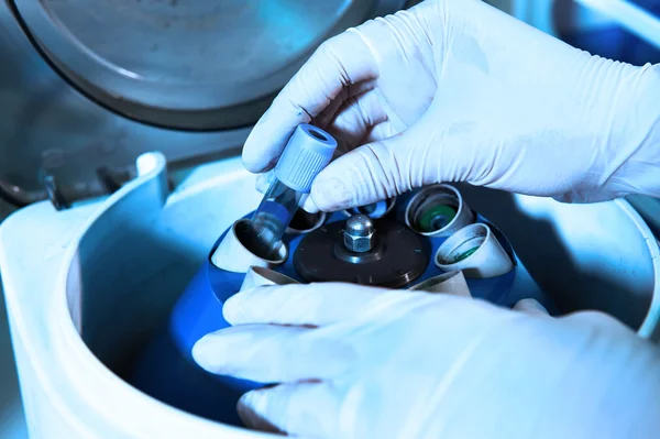 Blood testing in laboratory — Stock Photo, Image