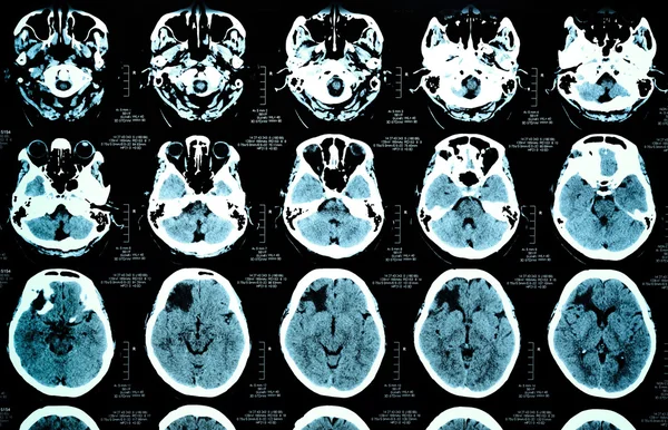 Obrázky z počítačové tomografie — Stock fotografie