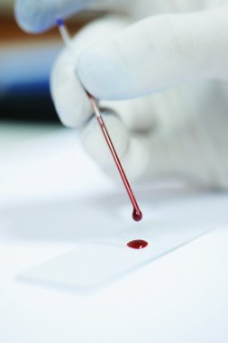 kan laboratuarda test