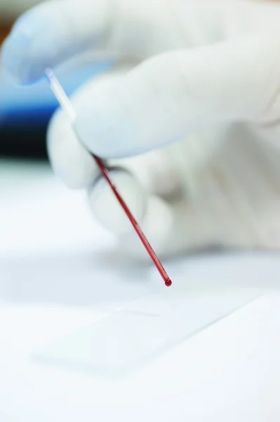 Blood testing in laboratory — Stock Photo, Image