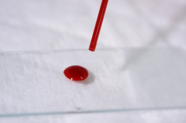 kan laboratuarda test