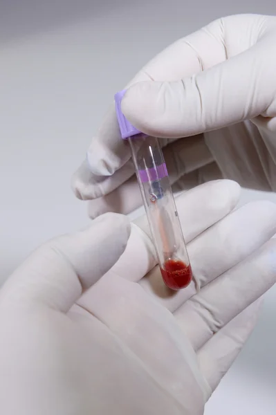 Tubo de análisis de sangre en un laboratorio —  Fotos de Stock