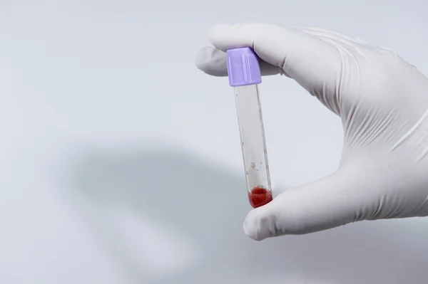 Tubo de análisis de sangre en un laboratorio — Foto de Stock