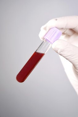 Gri arka plan üzerinde test tüpü içinde kan tutan el