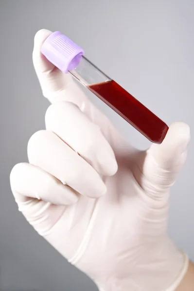 Mano sosteniendo sangre en tubo de ensayo sobre fondo gris — Foto de Stock