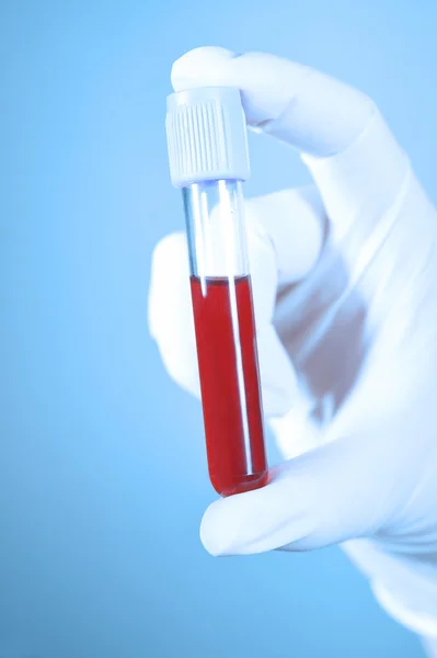 Portare il sangue in provetta con filtro blu — Foto Stock