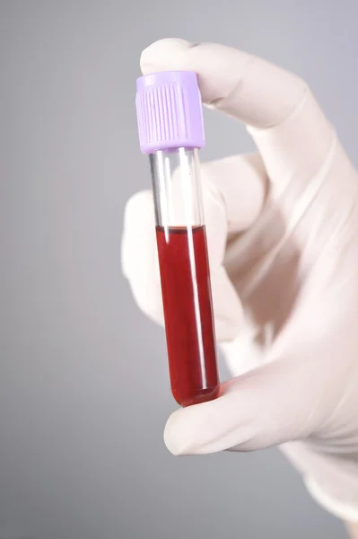 Mano sosteniendo sangre en tubo de ensayo sobre fondo gris —  Fotos de Stock